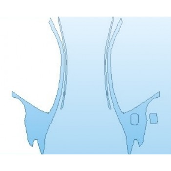 PAINT PROTECTION KIT - 2019 BMW 5 SERIES 530E M-SPORT SEDAN ROOF NO WRAPPED EDGES - PRECUT PPF CLEAR BRA WRAP