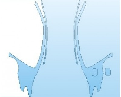 Precut PPF Kit – Clear Bra Paint Protection Film PAINT PROTECTION KIT - 2019 BMW 5 SERIES 530E M-SPORT SEDAN ROOF NO WRAPPED EDGES - PRECUT PPF CLEAR BRA WRAP