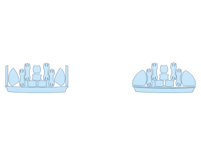 PAINT PROTECTION KIT - 2024 HONDA ACCORD TOURING HYBRID MIRRORS - DOOR CUPS - LUGGAGE AREA - PRECUT PPF CLEAR BRA WRAP