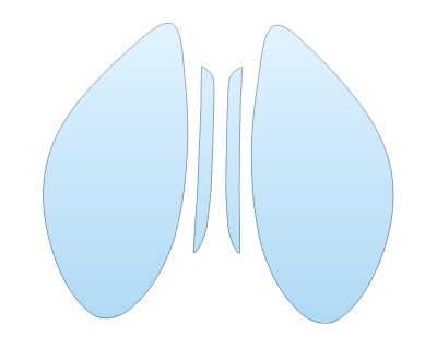 PAINT PROTECTION KIT - 2023 PORSCHE 718 BOXSTER CAYMAN S HEADLIGHTS AND FOGLIGHTS - PRECUT PPF CLEAR BRA WRAP